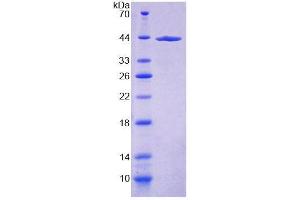 SDS-PAGE (SDS) image for Collagen, Type VI (COL6) (AA 1-336) protein (His tag) (ABIN6239252) (COL6 Protein (AA 1-336) (His tag))