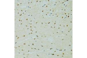 Immunohistochemistry of paraffin-embedded rat heart using RCC1 antibody (ABIN5973761) at dilution of 1/100 (40x lens). (RCC1 Antikörper)