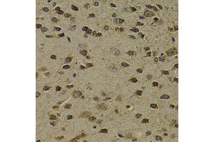 Immunohistochemistry of paraffin-embedded mouse brain using OGG1 antibody at dilution of 1:200 (400x lens). (OGG1 Antikörper)