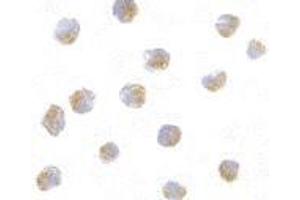 Immunocytochemistry of ATF6 in A20 with this product atF6 antibody at 10 μg/ml.