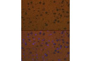 Immunofluorescence analysis of mouse brain cells using Talin 2 Rabbit mAb (ABIN7270720) at dilution of 1:100 (40x lens). (TLN2 Antikörper)