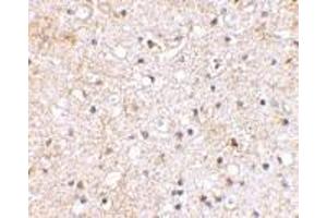 Immunohistochemical staining of human brain tissue using AP30380PU-N Grik1 antibody at 2. (GRIK1 Antikörper  (C-Term))