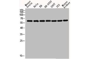 Western blot analysis of mouse-brain HELA KB SH-SY5Y 293T 3T3 Mouse-kidney lysis using GNL3L antibody. (GNL3L Antikörper  (Internal Region))