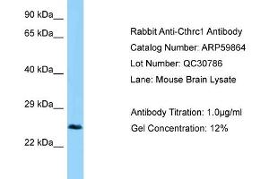 Western Blotting (WB) image for anti-Collagen Triple Helix Repeat Containing 1 (CTHRC1) (C-Term) antibody (ABIN2788242) (CTHRC1 Antikörper  (C-Term))