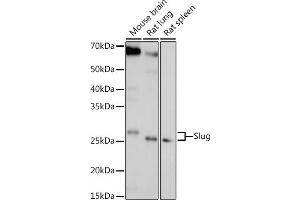 Western blot analysis of extracts of various cell lines, using Slug antibody (ABIN6127298, ABIN6148181, ABIN6148183 and ABIN6217314) at 1:1000 dilution. (SLUG Antikörper  (AA 126-268))