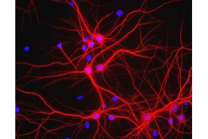 View of mixed neuron/glial cultures stained with MAP2 / MAP-2 antibody (red). (MAP2 Antikörper)