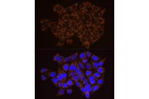 Immunofluorescence analysis of HeLa cells using CECR5 Rabbit mAb (ABIN7266128) at dilution of 1:100 (40x lens). (CECR5 Antikörper)