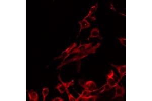 ABIN6268760 staining Hela by IF/ICC. (PRLHR Antikörper  (Internal Region))