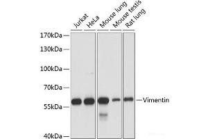 Western blot analysis of extracts of various cell lines using Vimentin Polyclonal Antibody at dilution of 1:1000. (Vimentin Antikörper)
