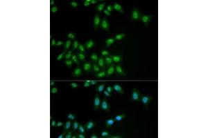 Immunofluorescence analysis of MCF7 cells using HPS1 Polyclonal Antibody (HPS1 Antikörper)