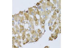 Immunohistochemistry of paraffin-embedded human liver injury using BNIP3 antibody. (BNIP3 Antikörper)