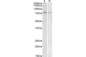 Western Blotting (WB) image for anti-BTB and CNC Homology 1, Basic Leucine Zipper Transcription Factor 1 (BACH1) (AA 250-263) antibody (ABIN1590110)