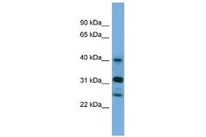 WB Suggested Anti-PPHLN1 Antibody Titration: 0. (PPHLN1 Antikörper  (N-Term))