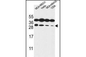 STX10 Antibody (N-term) (ABIN653883 and ABIN2843130) western blot analysis in MDA-M,Hela,MDA-M,CEM cell line lysates (35 μg/lane). (Syntaxin 10 Antikörper  (N-Term))