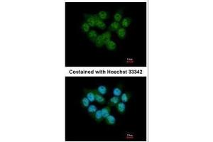 ICC/IF Image Immunofluorescence analysis of paraformaldehyde-fixed A431, using SEPHS2, antibody at 1:500 dilution. (SEPHS2 Antikörper)