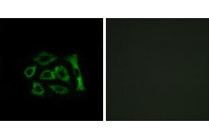 Peptide - +Western blot analysis of extracts from HUVEC cells and COLO cells, using ERD22 antibody. (KDELR2 Antikörper  (Internal Region))