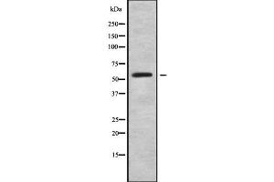 Western blot analysis of RFTN2 using A549 whole cell lysates (RFTN2 Antikörper  (C-Term))