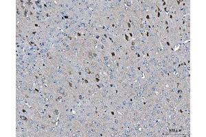 IHC analysis of ARFGAP1 using anti-ARFGAP1 antibody (ABIN4886474).