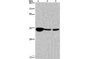 Western blot analysis of Human testis tissue, 293T and A 172 cell, using LZTFL1 Polyclonal Antibody at dilution of 1:300 (LZTFL1 Antikörper)