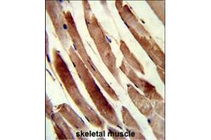 Formalin-fixed and paraffin-embedded human skeletal muscle reacted with TAGLN Antibody (N-term), which was peroxidase-conjugated to the secondary antibody, followed by DAB staining. (Transgelin Antikörper  (N-Term))