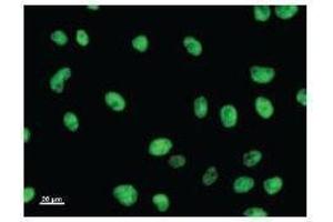 Immunostaining analysis in HeLa cells. (E2F6 Antikörper)