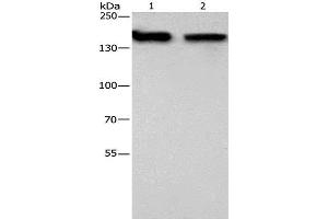 Western Blot analysis of 293T and hela cell using NCAPD2 Polyclonal Antibody at dilution of 1:425 (NCAPD2 Antikörper)