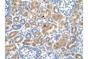 SLC38A1 antibody was used for immunohistochemistry at a concentration of 4-8 ug/ml to stain Epithelial cells of renal tubule (arrows) in Human Kidney. (SLC38A1 Antikörper  (Middle Region))
