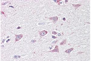 Anti-GOLGA6 antibody IHC staining of human brain, cortex. (GOLGA6A Antikörper  (AA 536-547))