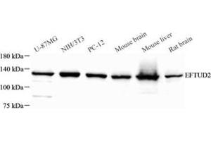 Western blot analysis of EFTUD2 (ABIN7073810) at dilution of 1: 500 (EFTUD2 Antikörper)