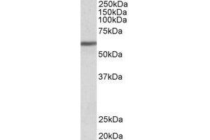 Western Blotting (WB) image for anti-Zinc Finger Protein 703 (ZNF703) (Internal Region) antibody (ABIN2466469) (ZNF703 Antikörper  (Internal Region))