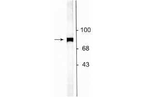 Western blot of rat striatal lysate showing specific labeling of the ~75 kDa NSF protein. (NSF Antikörper  (C-Term))