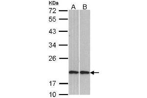 WB Image Sample (30 ug of whole cell lysate) A: H1299 B: Molt-4 , 12% SDS PAGE antibody diluted at 1:1000