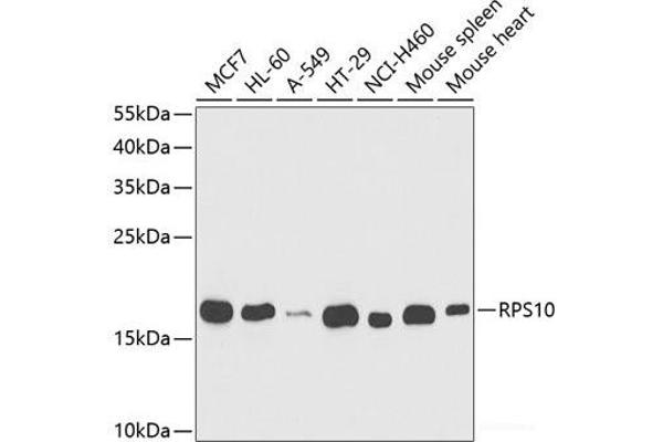 RPS10 anticorps