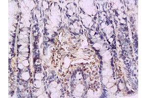 Formalin-fixed and paraffin embedded rat colon tissue labeled with Anti-P-selectin Polyclonal Antibody (ABIN670131), Unconjugated at 1:200, followed by conjugation to the secondary antibody and DAB staining (P-Selectin Antikörper  (AA 701-768))