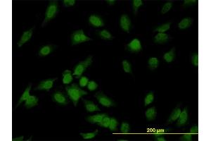 Immunofluorescence of monoclonal antibody to IRAK1 on HeLa cell. (IRAK1 Antikörper  (AA 530-693))
