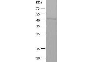 Western Blotting (WB) image for Acetyl-CoA Acetyltransferase 1 (ACAT1) (AA 34-427) protein (His tag) (ABIN7121640)