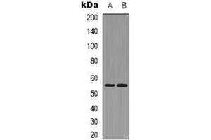 Western blot analysis of RUNX2 expression in K562 (A), Hela (B) whole cell lysates. (RUNX2 Antikörper)