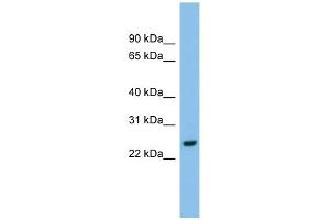 AK2 antibody used at 1 ug/ml to detect target protein. (Adenylate Kinase 2 Antikörper  (Middle Region))