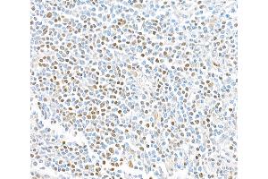 Immunohistochemistry (IHC) image for anti-Transcription Factor 7 (T-Cell Specific, HMG-Box) (TCF7) (AA 200-250) antibody (ABIN7449420) (Rekombinanter TCF7 Antikörper  (AA 200-250))