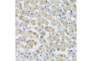Immunohistochemistry of paraffin-embedded human liver injury using SNAP29 antibody at dilution of 1:100 (x40 lens). (SNAP29 Antikörper)