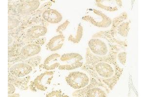 ABIN6262953 and ABIN6278151 at 1/100 staining human normal colon tissue by IHC-P.