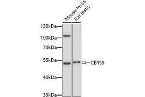 Western blot analysis of extracts of various cell lines, using CERS5 antibody (ABIN7268175) at 1:1000 dilution. (LASS5 Antikörper  (AA 1-100))
