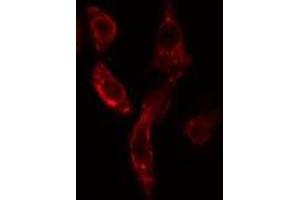 ABIN6275886 staining COLO205 cells by IF/ICC.