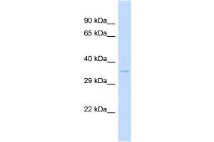 Host:  Rabbit  Target Name:  SPPL2B  Sample Type:  293T Whole cell lysates  Antibody Dilution:  1. (SPPL2B Antikörper  (N-Term))