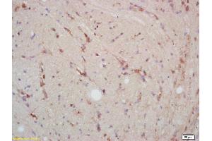 Formalin-fixed and paraffin embedded rat brain labeled with Rabbit Anti p38MAPK/MAPK14/p38Alpha Polyclonal Antibody, Unconjugated (ABIN671241) at 1:200 followed by conjugation to the secondary antibody and DAB staining (MAPK14 Antikörper  (AA 141-240))