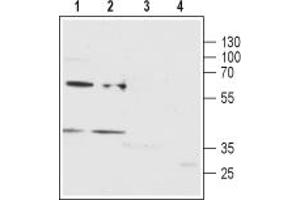 anti-Purinergic Receptor P2Y, G-Protein Coupled, 12 (P2RY12) (AA 270-282), (Extracellular) antibody