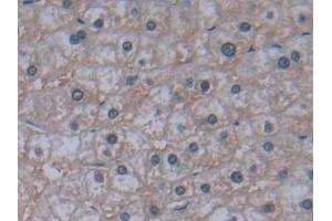 Immunohistochemistry (IHC) image for anti-Jagged 2 (JAG2) (AA 714-981) antibody (ABIN7439534)