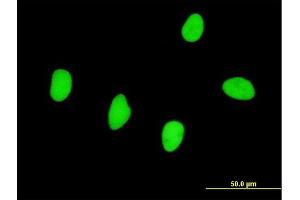 Immunofluorescence of monoclonal antibody to RBMS2 on HeLa cell. (RBMS2 Antikörper  (AA 308-407))