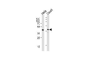 Western blot analysis of lysates from Hela,Daudi cell line (from left to right),using CREB3L4 Antibody (monoclonal) (M01) (ABIN1882056 and ABIN2838484). (USF1 Antikörper  (AA 1-310))