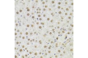 Immunohistochemistry of paraffin-embedded rat liver using HDGF Antibody (ABIN1876535) at dilution of 1:100 (40x lens). (HDGF Antikörper)